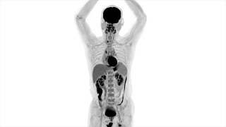 Human Images from World’s First Total-Body PET Scanner Unveiled