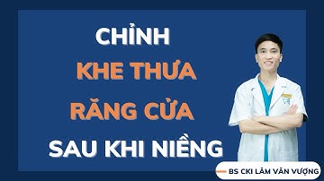 Cách Chỉnh Khe Thưa Răng Cửa Sau Khi Niềng?