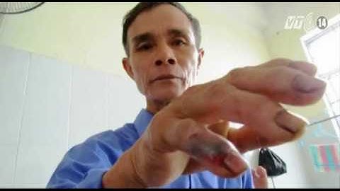 VTC14_Sơ cấp cứu khi bị rắn lục đuôi đỏ tấn công