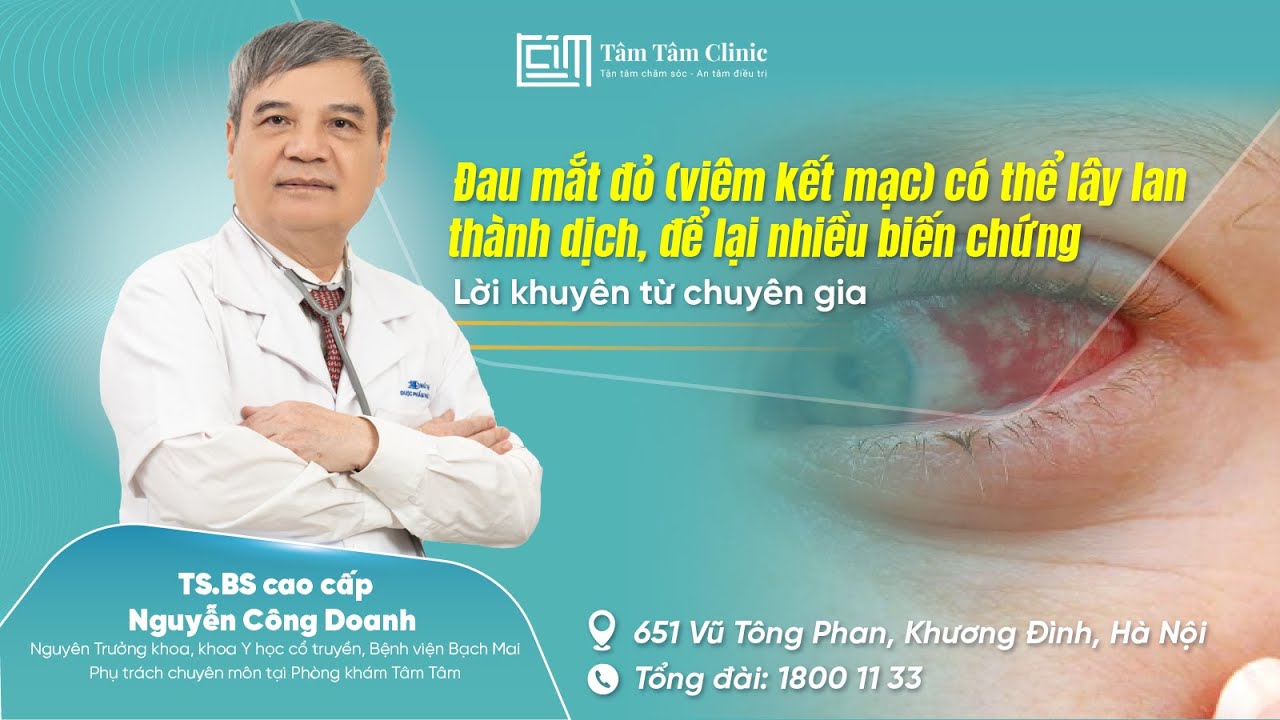 Đau mắt đỏ: Một người mắc, cả nhà bị lây - Phương pháp điều trị hiệu quả