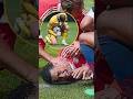 Musiala Injury Vs Psg In The Club World Cup Football Viralshort Musiala Injury Vs Psg In The Club World Cup Football Viralshort
