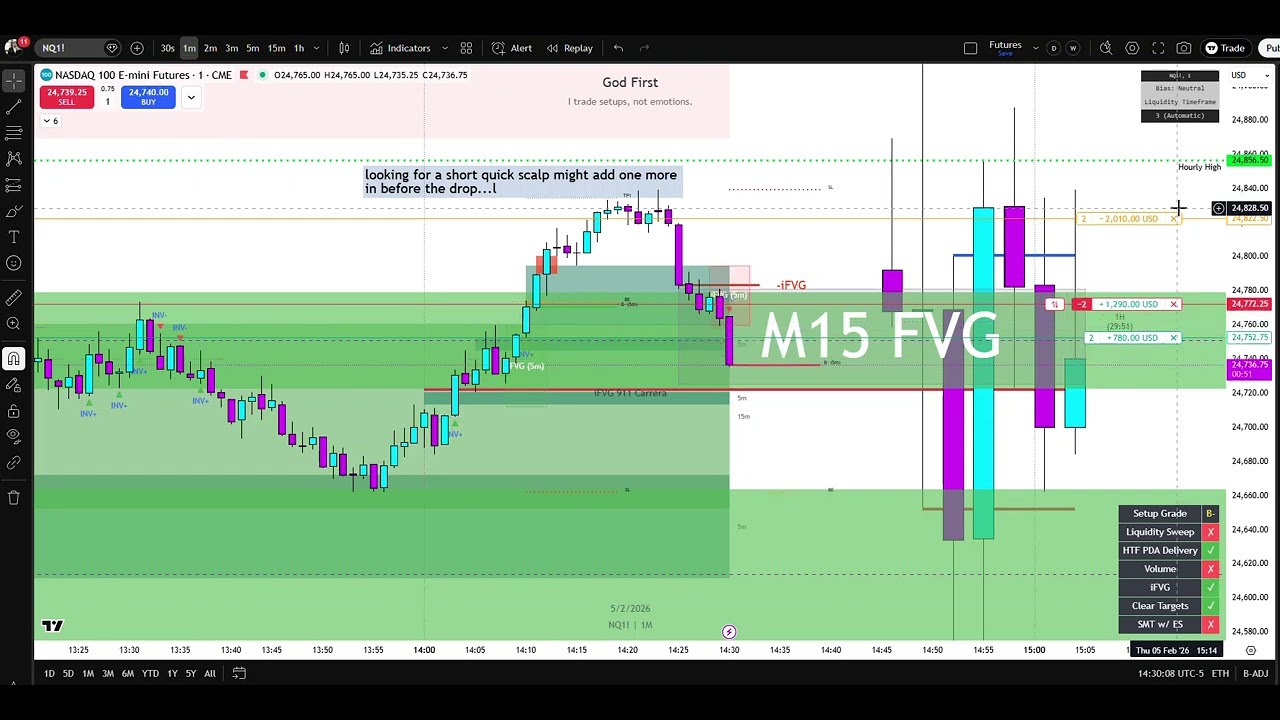 NQ Futures Scalping With IFVG 911 Carrera (Live Market Speculation)