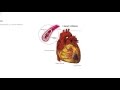 Streptokinase - the revolutionary drug that changed treatment of heart attacks