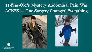 The Hidden Cause of His GI Pain: Anterior Cutaneous Nerve Entrapment