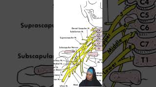 Brachial Nightmares #dptstudent #otstudent #dpt #physicaltherapystudent #physicaltherapyschool