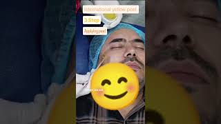 international yellow peel for pigmentation.