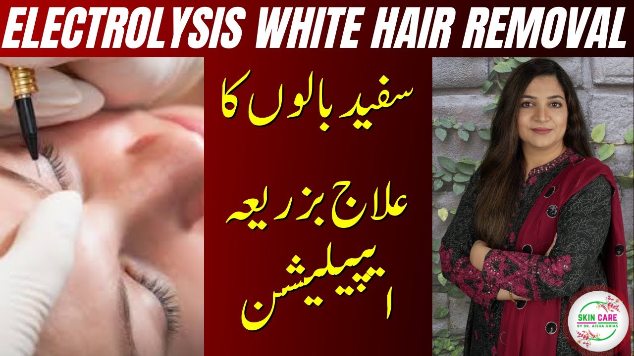 Electrolysis Of White Facial Hair Removal White Hair Removal سفید