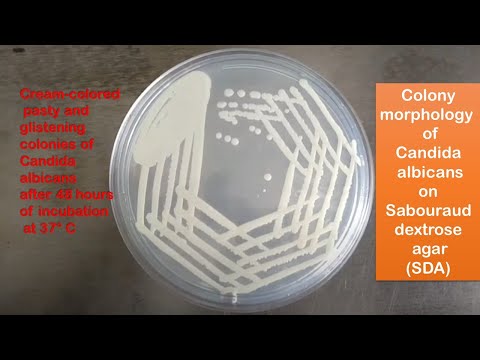Difference Between Nutrient Agar And Sabouraud Agar