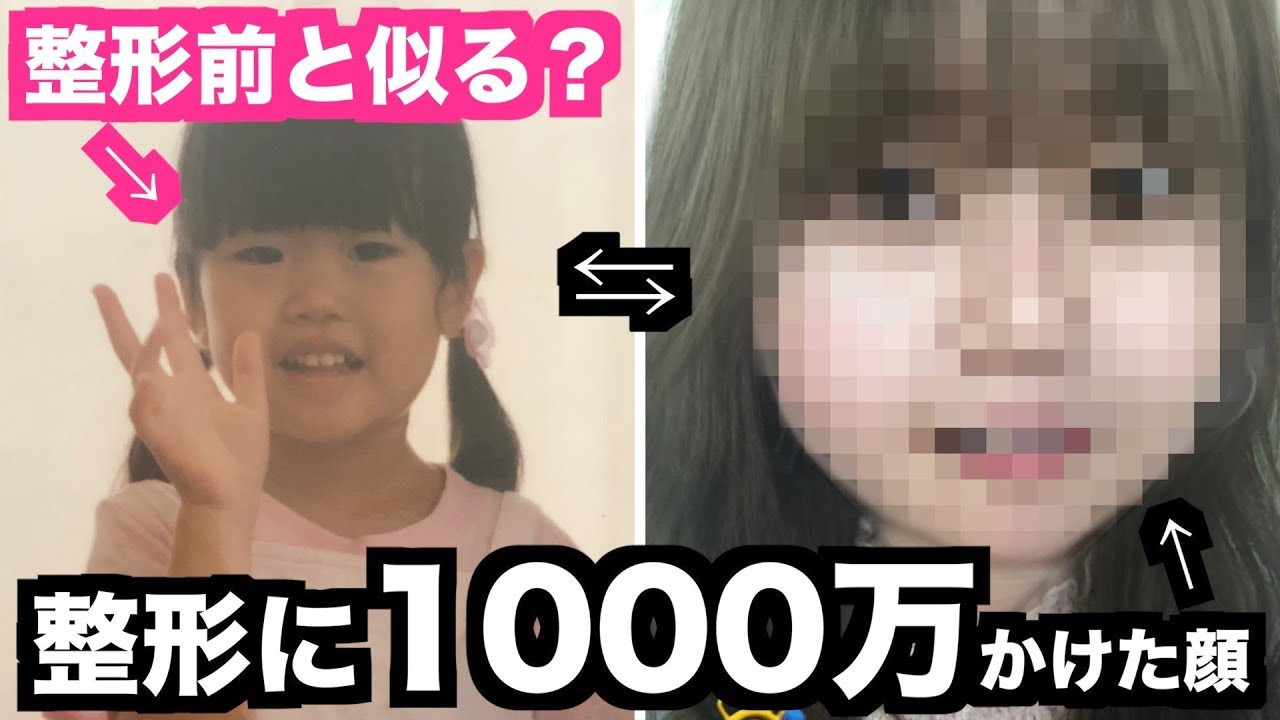 1000万円分変わった顔に 子どもフィルター かけたら実際の幼少期の顔と比べてどうなる Youtube