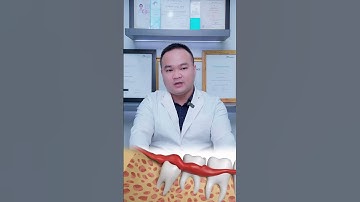 Có cần nhổ răng khôn khi niềng? I Nha Khoa Smile HT #niengrang #smileht #nhakhoasmileht #nhakhoa