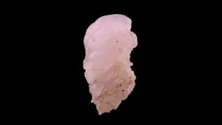 Pink Chalcedony: A Stone That Removes Restrictions