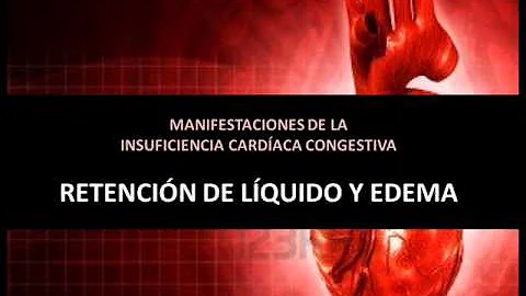 ¿La retención de líquidos es siempre insuficiencia cardíaca?