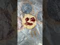 Mr. Strawberry Jelly Face Has To Get To The Doctor
