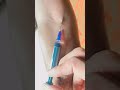 IV injection #reels #usa #youtubeshorts #trending #viral #trendingshorts #ivcannula #medical