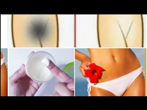caseros remedios hemorroides Cómo aclarar y blanquear la zona del bikini.