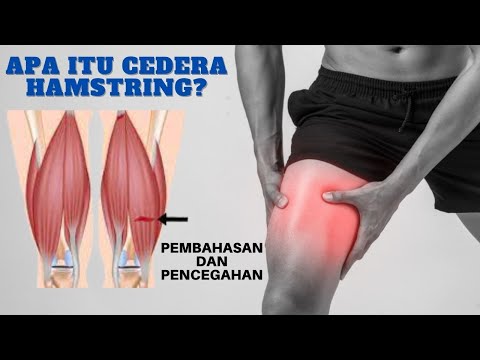 Video: Cedera - Penyebab Dan Gejala Cedera. Diagnosa