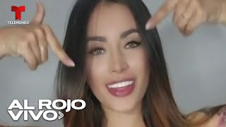 Tiktoker colombiana se hace viral al operarse para cambiar el color de sus ojos