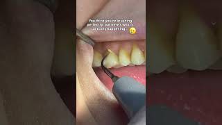#dental
