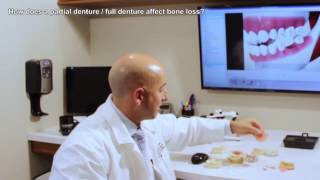 How does a denture affect bone loss? | Daniel Daniel Dentistry