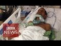 Indian injured by US police speaks out - BBC News