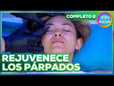 Excess skin and sagging eyelids? This treatment rejuvenates! 👁️✨ | Venga La Alegría