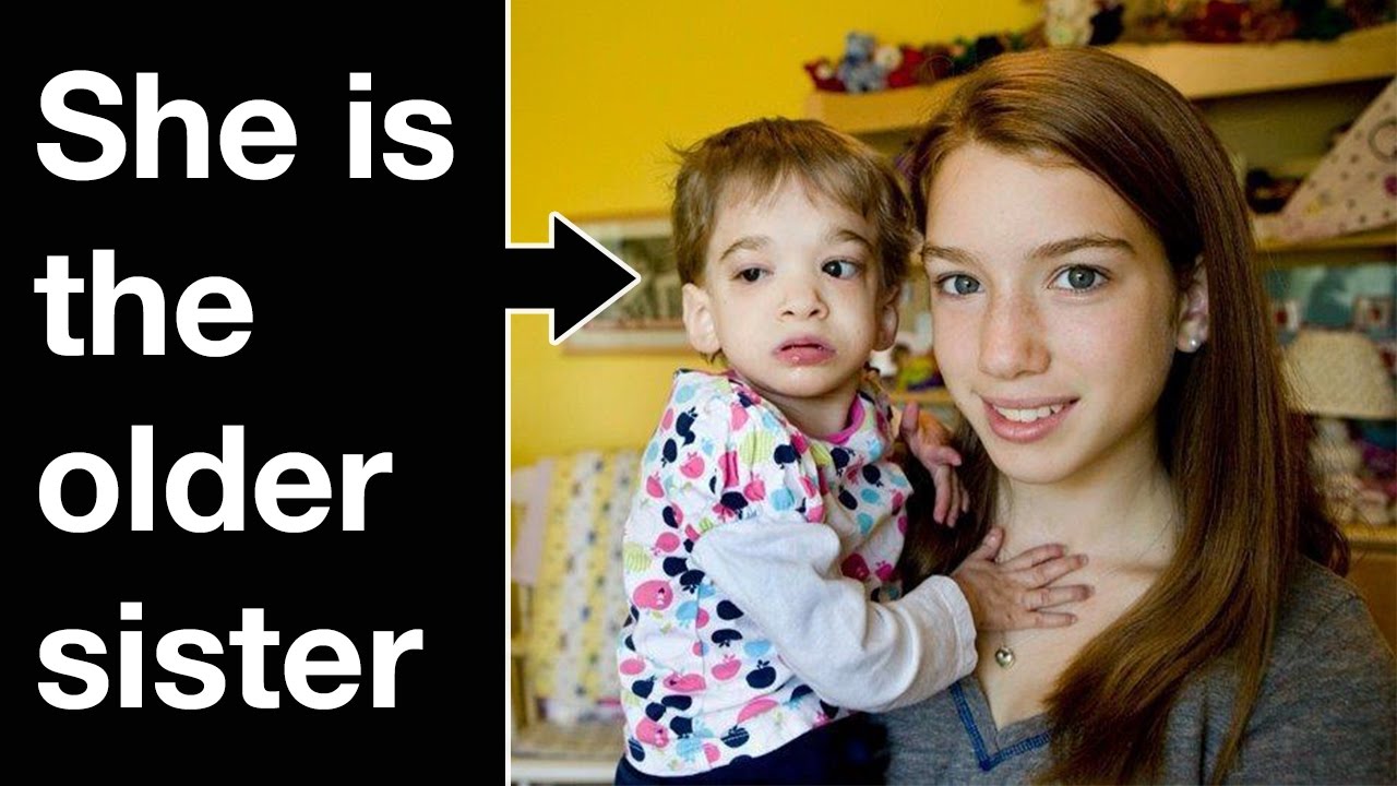 Top 15 Mysterious And Strange Medical Conditions YouTube