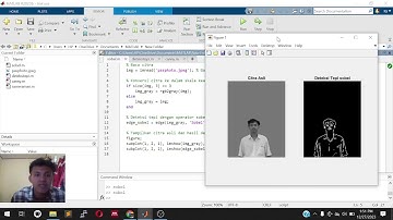 Segmentasi citra deteksi tepi sobel, prewit, dan canny
