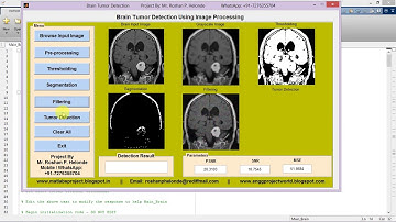 Matlab Code for Brain Tumor Detection Using Image Processing