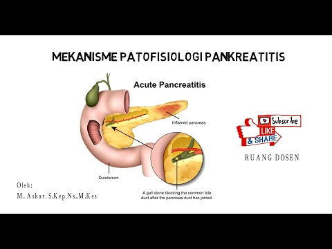 Video: Pankreatitis Reaktif Pada Anak: 9 Kemungkinan Penyebab