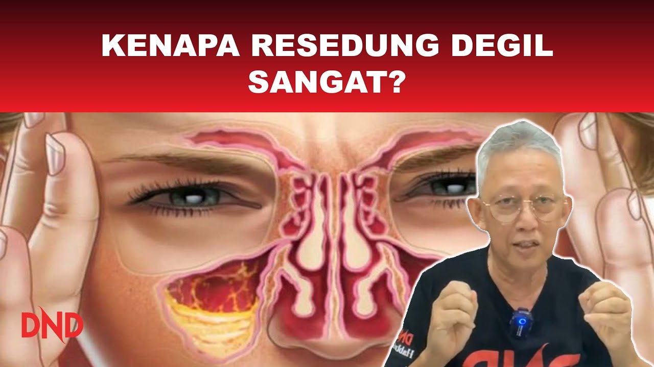 RESDUNG! Sampai nak PUTUS HIDUNG kenapa degil sangat! Apa Nak Buat?