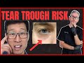 Dr tim reacts why i stopped filling tear troughs