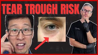 Dr Tim Reacts: Why I Stopped Filling Tear Troughs