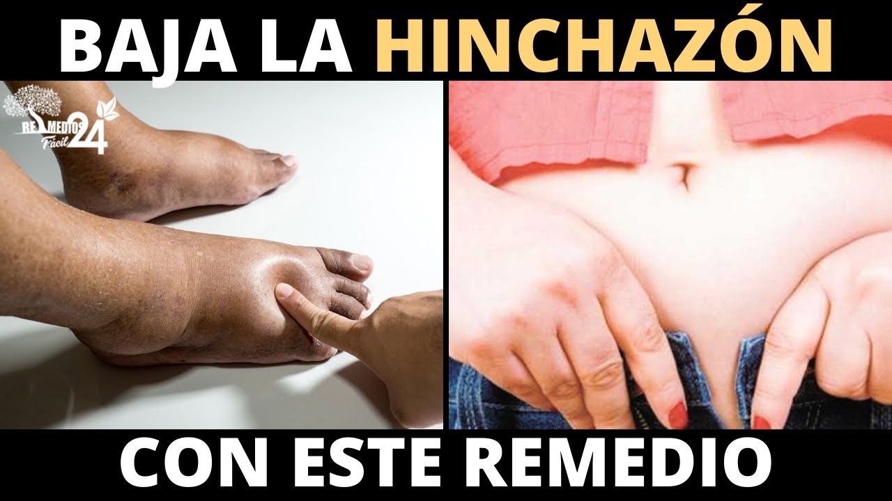 remedio herbolario para retencion de liquidos