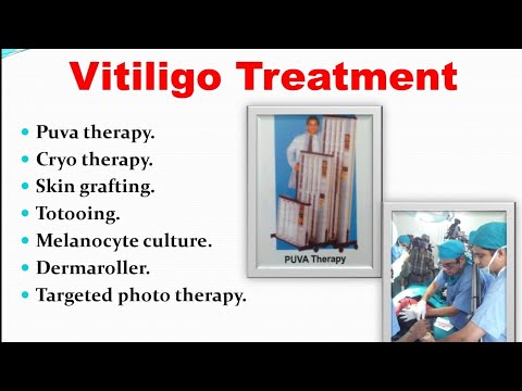 Talk On Alopecia Dr Bhutada E Course In Hair Youtube