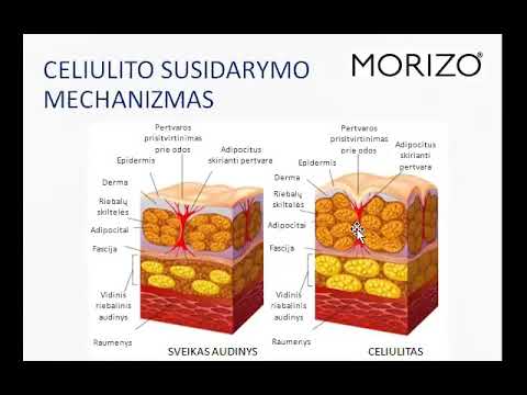 Video: Skirtumas Tarp Lipolizės Ir Lipogenezės