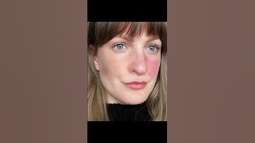 Adobe Photoshop 2025 Face Red mark remove on Photoshop #photography #art #photo @AMTrends003