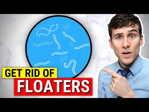 Video: 3 Möglichkeiten, Eye Floaters loszuwerden