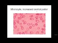 red cell morphology (heamatology)