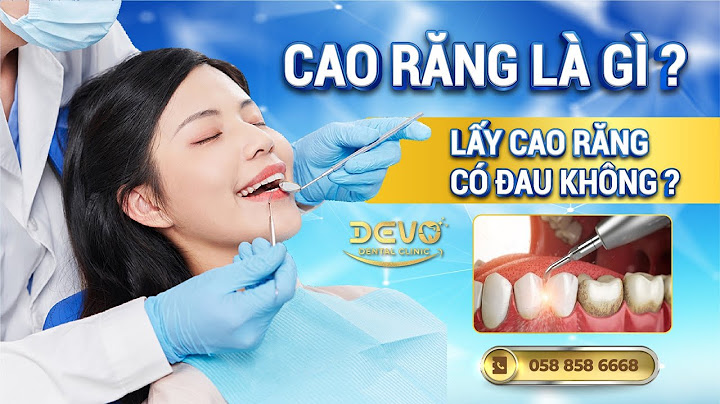 Lấy cao răng hết bao nhiêu tiền năm 2024