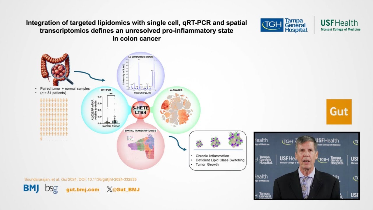 Lipidomics in colon cancer