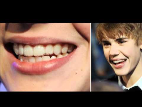 Justin Bieber with braces - YouTube