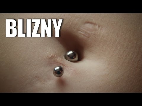 BLIZNY po przekłuciach - jak się ich pozbyć? ✪ Bezpieczny piercing ✪