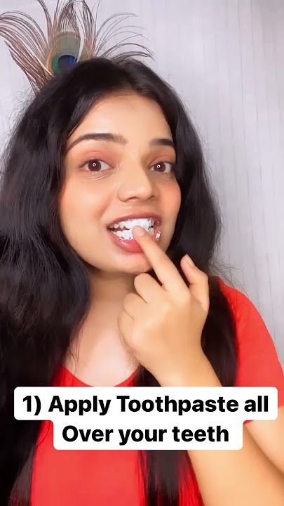 Teeth Whitening at Home 🏡✨           Follow Me on Instagram & YouTube : Beauty’s Crown 👑
