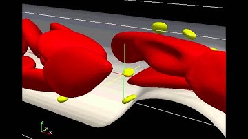 Simulations of thrombotic adhesion to arteriosclerotic lesions