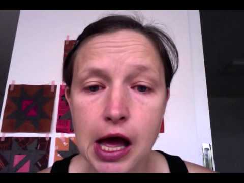 MISDIAGNOSED. Ramsay Hunt Syndrome, Day 2. - YouTube
