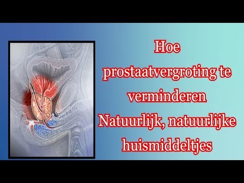 Video: Analyse Van Prostaatsecretie: Decodering, Voorbereiding, Hoe Te Doen