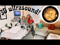 3D/4D Ultrasound Of Our Third Baby *Cutest Sibling Reaction*