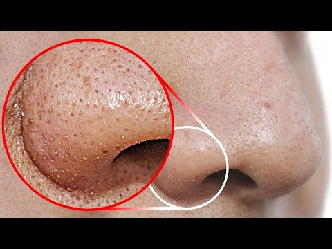 Video: Cum să albească pielea: 10 pași (cu imagini)