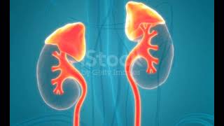 What are kidney stones symptoms of kidney stones, Risk factors and prevention of kidney stonesyt
