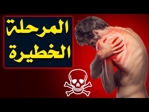 فيديو: لماذا يعني الكتف البارد؟